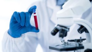 Kādēļ tiek veiktas holesterīna analīzes